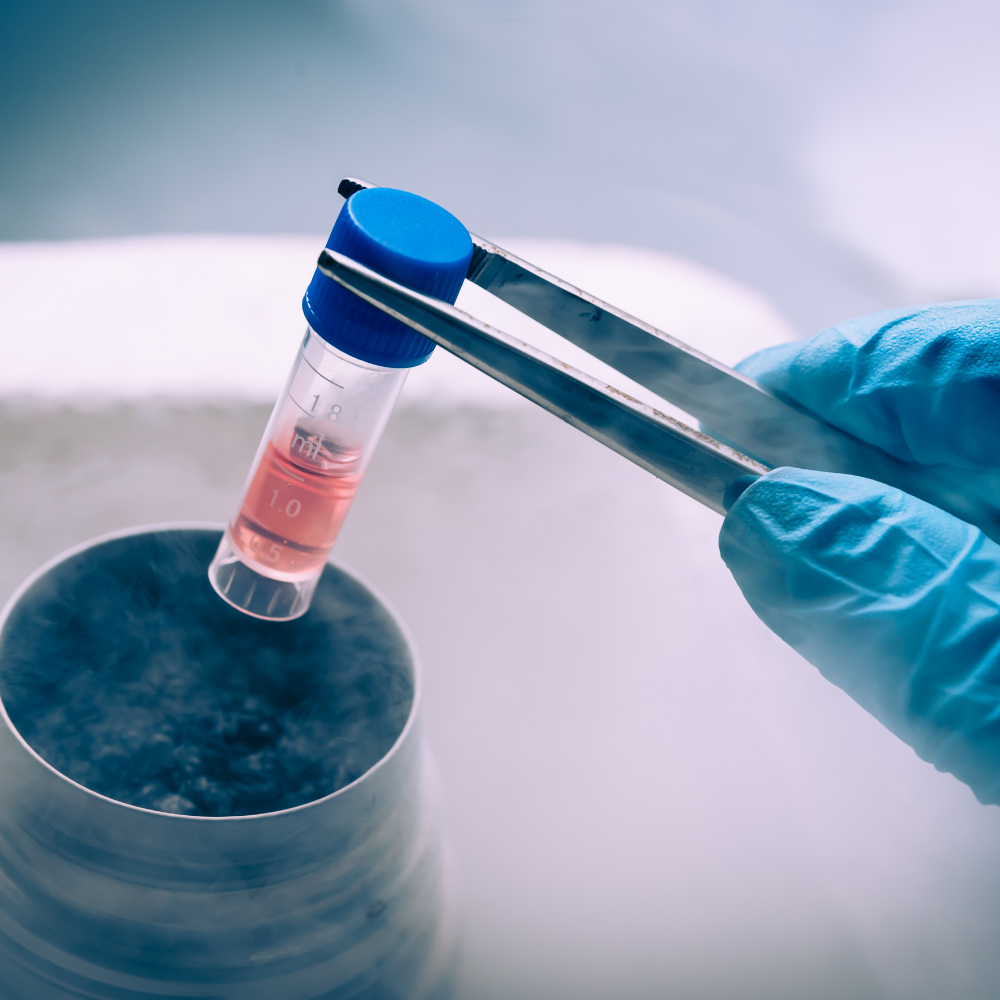 Kök Hücre Tedavisi